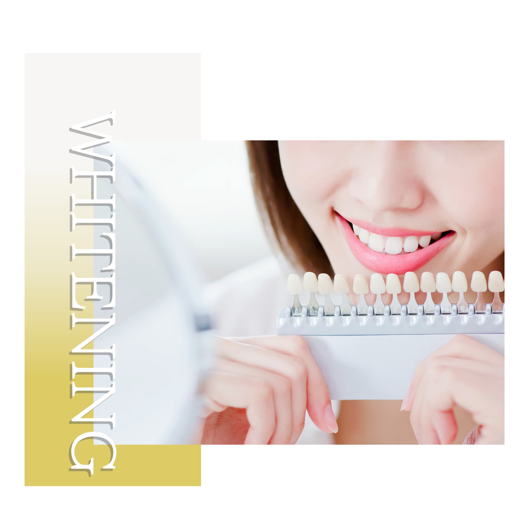 ホワイトニング