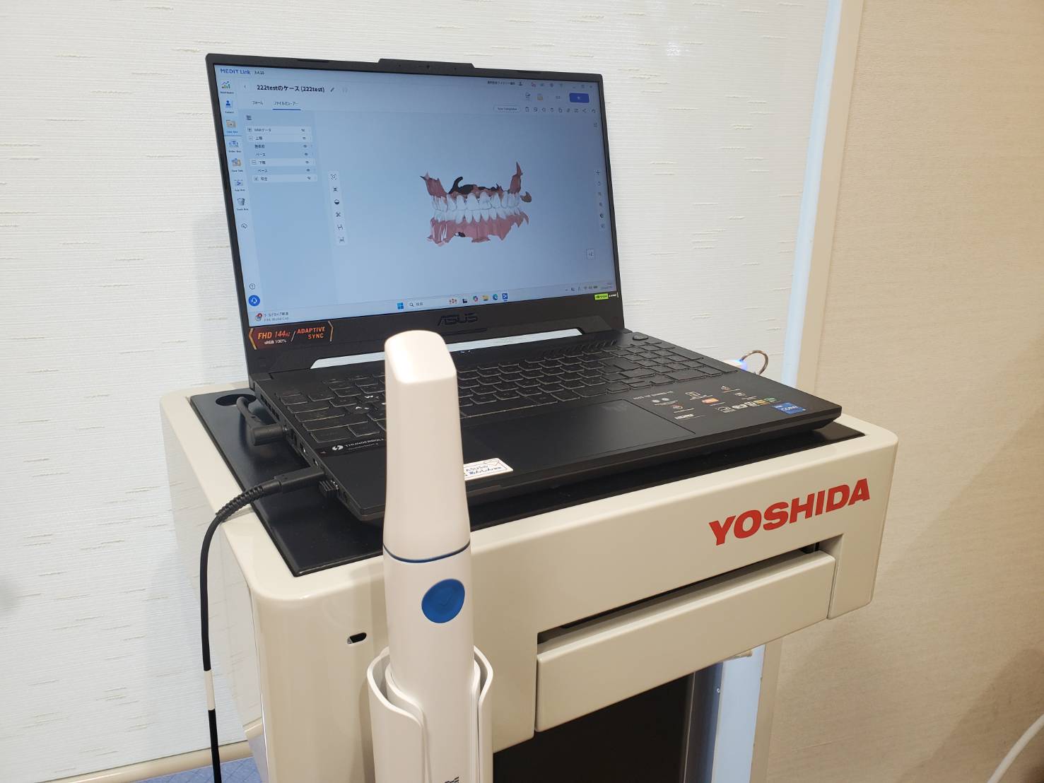 新型口腔内スキャナー メディット i900
